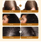 Sérum d'huile de Batana pour la croissance des cheveux, huile essentielle pour cheveux à croissance rapide, soins capillaires de beauté, Essence Anti-perte de cheveux, réparation naturelle des cheveux endommagés