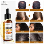 Sérum d'huile de Batana pour la croissance des cheveux, huile essentielle pour cheveux à croissance rapide, soins capillaires de beauté, Essence Anti-perte de cheveux, réparation naturelle des cheveux endommagés