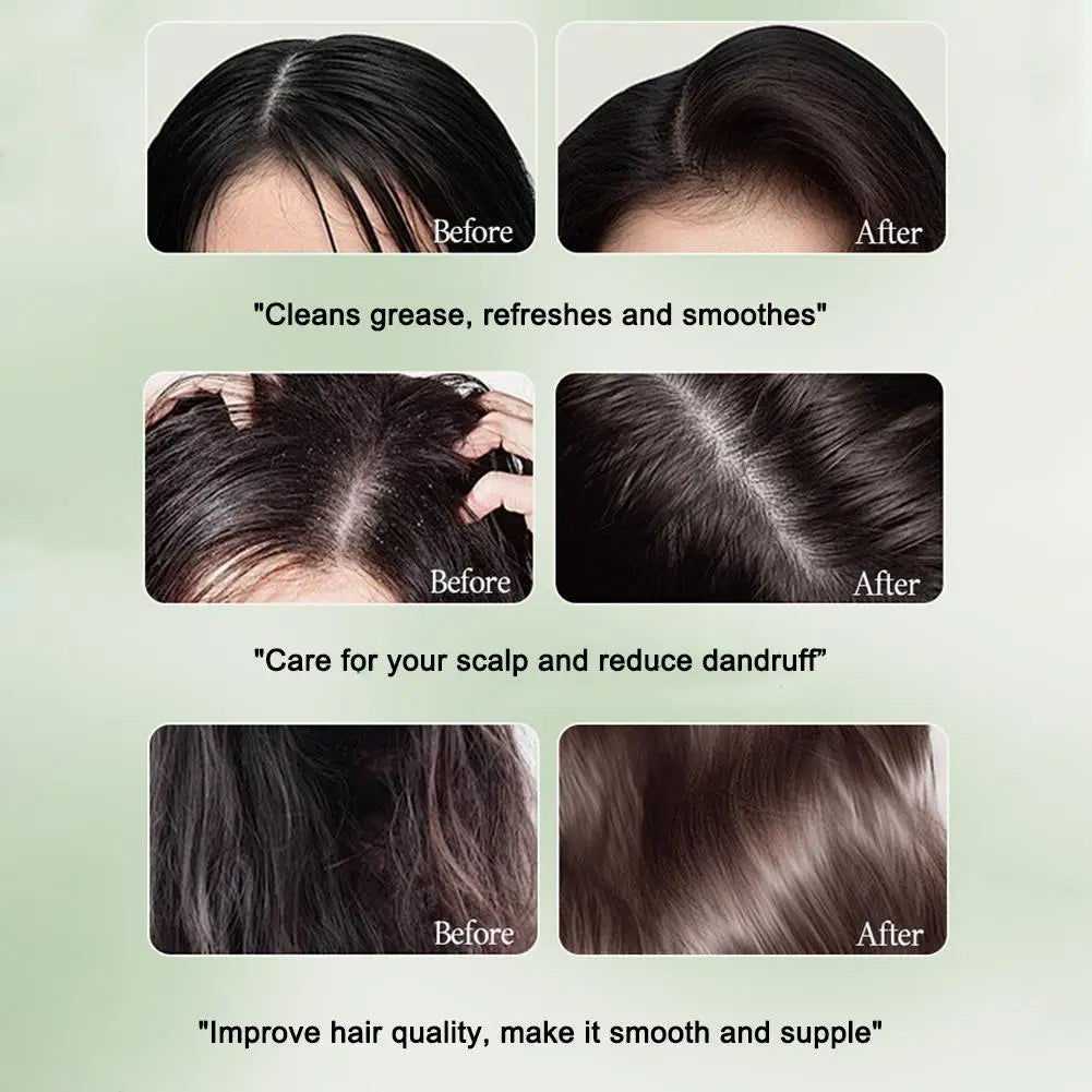 Ensemble de prévention de la perte de cheveux 1/2/3 pièces, huile essentielle pour la repousse rapide des cheveux, savon shampooing artisanal Usman, sérum capillaire, épaississement du cuir chevelu