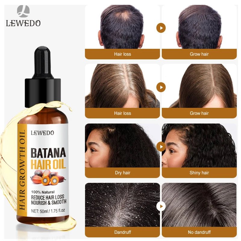 Sérum d'Huile de Batana — Soin Capillaire Intense, Réparation & Brillance - FATAONSérum d'Huile de Batana — Soin Capillaire Intense, Réparation & BrillanceBeauté femmeFATAON