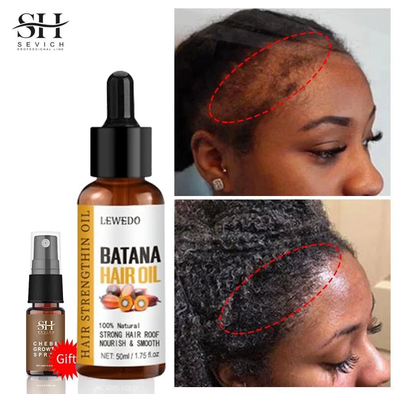 Sérum d'Huile de Batana — Soin Capillaire Intense, Réparation & Brillance - FATAONSérum d'Huile de Batana — Soin Capillaire Intense, Réparation & BrillanceBeauté femmeFATAON
