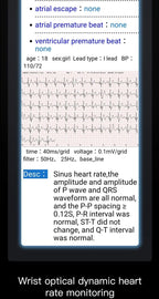 Smartwatch Ekg Bracelet intelligent étanche P11 Plus Bracelet intelligent traqueur d'activité sang oxygène Smartband Bracelet de Fitness - FATAONSmartwatch Ekg Bracelet intelligent étanche P11 Plus Bracelet intelligent traqueur d'activité sang oxygène Smartband Bracelet de FitnessFitness & SportFATAON